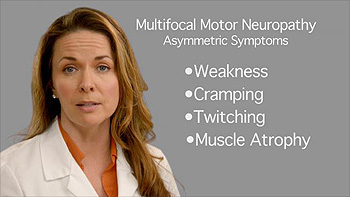 Multifocal Motor Neuropathy